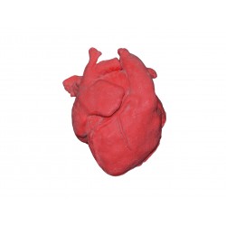 Pediatrické srdce s transpozicí velkých tepen TGA a defektem komorového septa