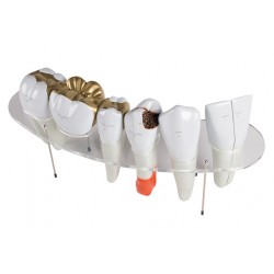 Série modelů zubů v 10 násobné velikosti - 7 částí