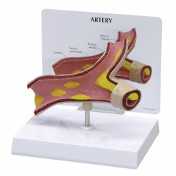 Model tepny s aterosklerózou