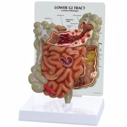 Model gastrointestinálního traktu