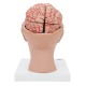 Mozek s tepnami vsazený do hlavy - 9 částí
