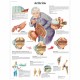 Artróza - 50 x 67 cm plakát anatomie / papír s lištami