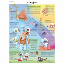 Alergie - 50 x 67 cm plakát anatomie / papír bez lišt