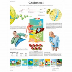 Cholesterol - 50 x 67 cm plakát anatomie / papír bez lišt