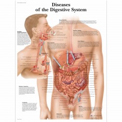 Nemoci trávicí soustavy - 50 x 67 cm plakát anatomie / papír bez lišt