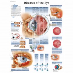Nemoci oka - 50 x 67 cm plakát anatomie / papír bez lišt