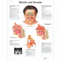Rinitida a Sinusitida - 50 x 67 cm plakát anatomie / papír bez lišt