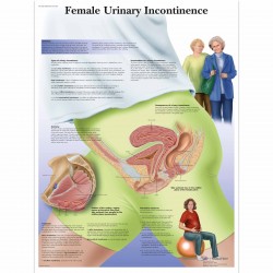 Inkontinence moči u žen - 50 x 67 cm plakát anatomie / papír bez lišt