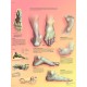 Deformace nohy - 50 x 67 cm plakát anatomie / papír bez lišt