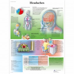 Bolest hlavy - 50 x 67 cm plakát anatomie / papír bez lišt